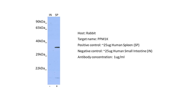 PPM1K Rabbit Polyclonal Antibody