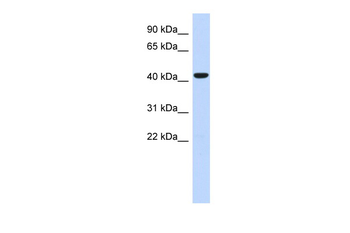 SGMS2 Rabbit Polyclonal Antibody