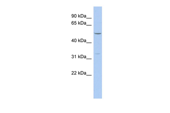 FBXO15 Rabbit Polyclonal Antibody