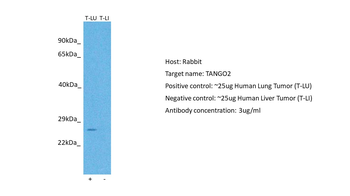 C22orf25 Rabbit Polyclonal Antibody