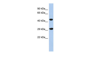 C22orf25 Rabbit Polyclonal Antibody