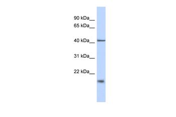TBC1D21 Rabbit Polyclonal Antibody