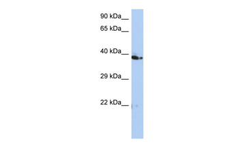 C10orf46 Rabbit Polyclonal Antibody
