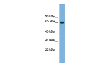 C8orf45 Rabbit Polyclonal Antibody