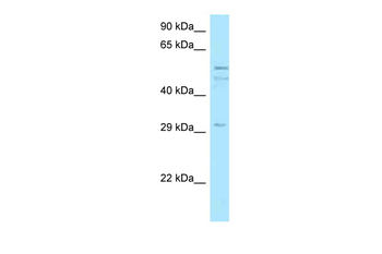 C11orf42 Rabbit Polyclonal Antibody