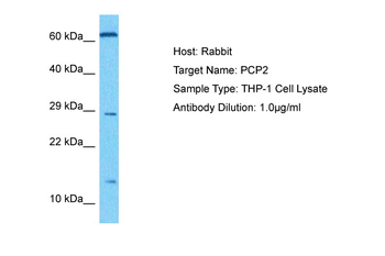 PCP2 Rabbit Polyclonal Antibody