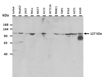 PLEKHA7 Rabbit Polyclonal Antibody