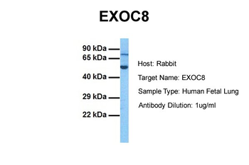 EXOC8 Rabbit Polyclonal Antibody