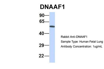 LRRC50 Rabbit Polyclonal Antibody