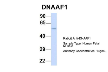 LRRC50 Rabbit Polyclonal Antibody