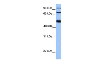 WDR49 Rabbit Polyclonal Antibody