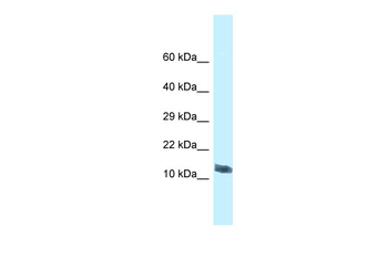 Morn4 Rabbit Polyclonal Antibody