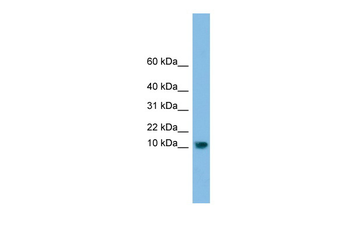 C13orf30 Rabbit Polyclonal Antibody