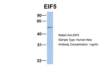 EIF5 Rabbit Polyclonal Antibody
