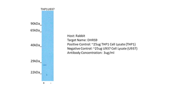 DHRS9 Rabbit Polyclonal Antibody
