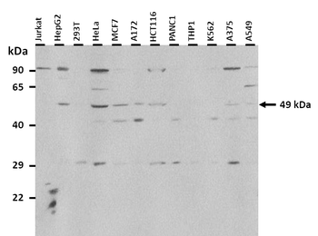 CMPK2 Rabbit Polyclonal Antibody