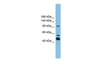 PLA2G4E Rabbit Polyclonal Antibody