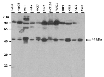 IL13RA2 Rabbit Polyclonal Antibody