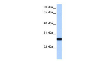 IL13RA2 Rabbit Polyclonal Antibody