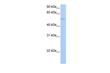 GRK4 Rabbit Polyclonal Antibody