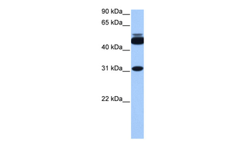 CYLC2 Rabbit Polyclonal Antibody