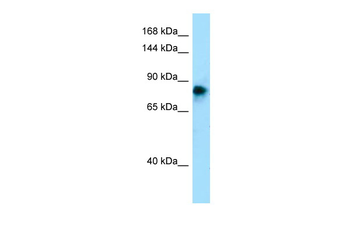 ADAM2 Rabbit Polyclonal Antibody