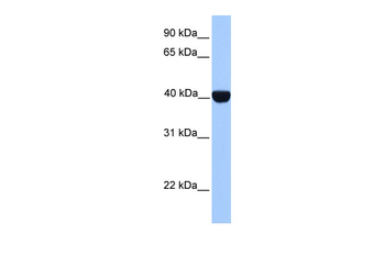 CSNK2A2 Rabbit Polyclonal Antibody