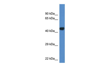 Pcyt2 Rabbit Polyclonal Antibody