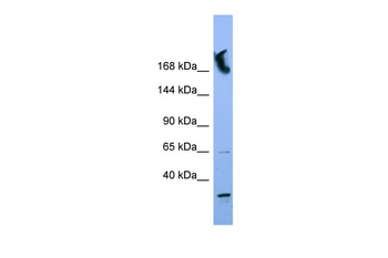 NUP155 Rabbit Polyclonal Antibody