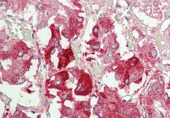 Nbr1 Rabbit Polyclonal Antibody