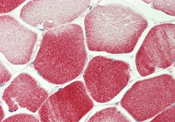 Nbr1 Rabbit Polyclonal Antibody
