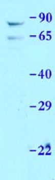 Prkaa1 Rabbit Polyclonal Antibody