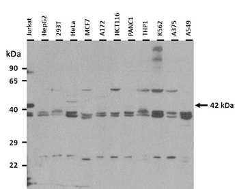 ST6GALNAC2 Rabbit Polyclonal Antibody