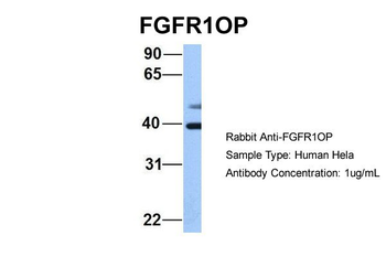 FGFR1OP Rabbit Polyclonal Antibody