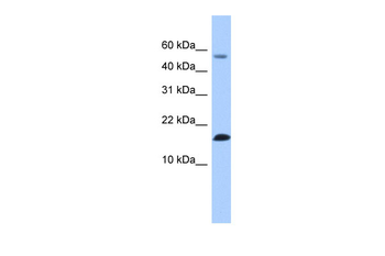 LYZL6 Rabbit Polyclonal Antibody