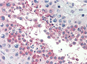 TSKS Rabbit Polyclonal Antibody