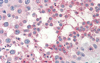 TSKS Rabbit Polyclonal Antibody