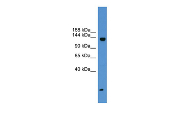 KIAA0999 Rabbit Polyclonal Antibody