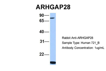 ARHGAP28 Rabbit Polyclonal Antibody