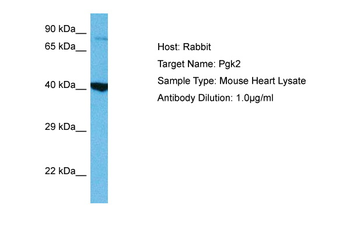 PGK2 Rabbit Polyclonal Antibody