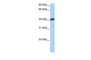PGK2 Rabbit Polyclonal Antibody