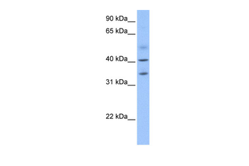 ZC3H14 Rabbit Polyclonal Antibody