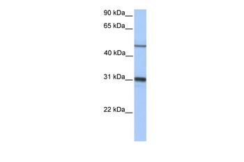 EPHX1 Rabbit Polyclonal Antibody
