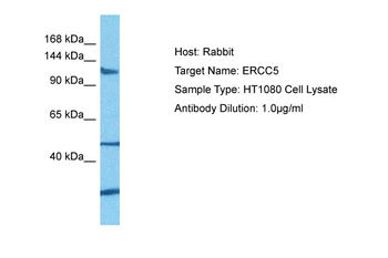 ERCC5 Rabbit Polyclonal Antibody
