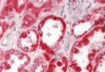 GLDC Rabbit Polyclonal Antibody