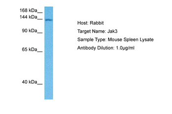 JAK3 Rabbit Polyclonal Antibody