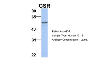 GSR Rabbit Polyclonal Antibody