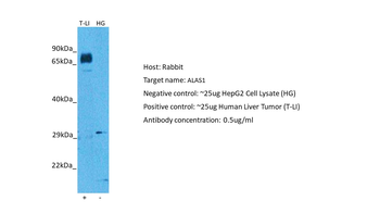 ALAS1 Rabbit Polyclonal Antibody