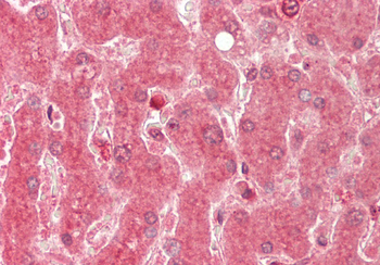 ALAS1 Rabbit Polyclonal Antibody
