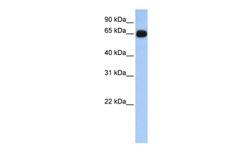 ALAS1 Rabbit Polyclonal Antibody